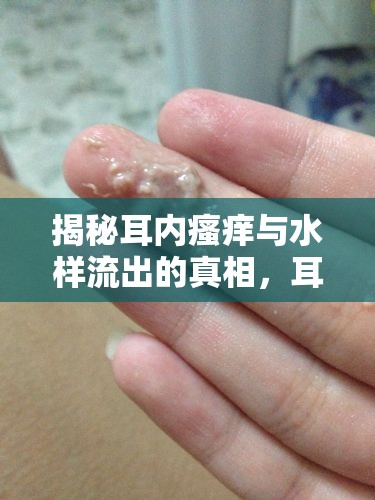 揭秘耳內(nèi)瘙癢與水樣流出的真相，耳蝸之謎
