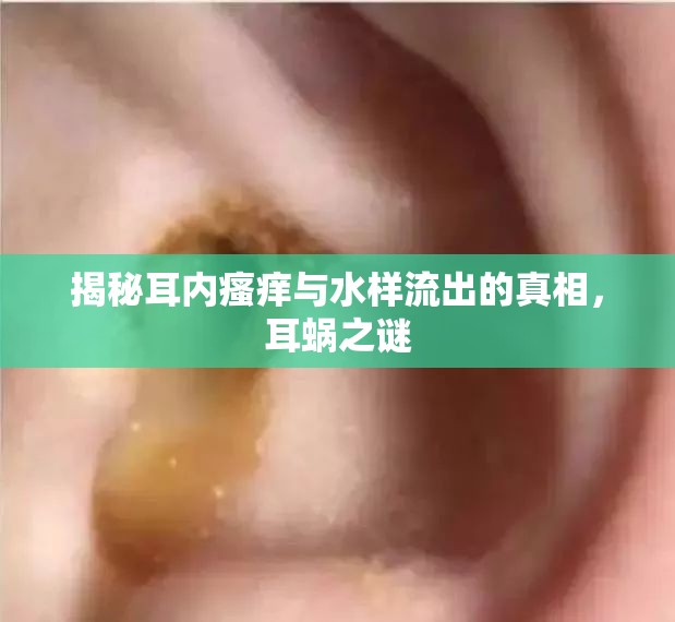 揭秘耳內(nèi)瘙癢與水樣流出的真相，耳蝸之謎