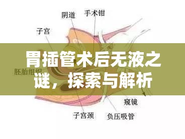 胃插管術后無液之謎，探索與解析
