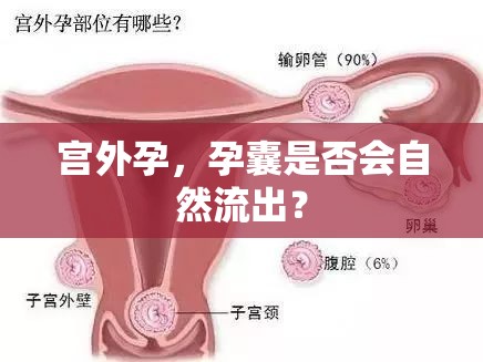 宮外孕，孕囊是否會(huì)自然流出？