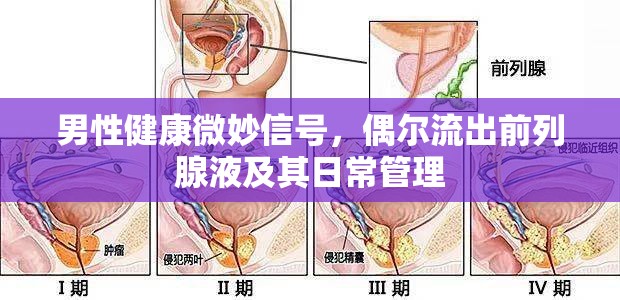 男性健康微妙信號(hào)，偶爾流出前列腺液及其日常管理