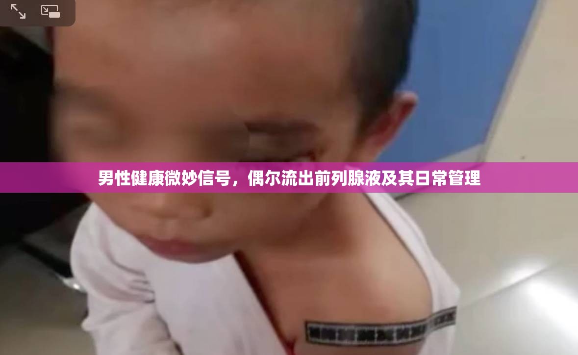 男性健康微妙信號(hào)，偶爾流出前列腺液及其日常管理