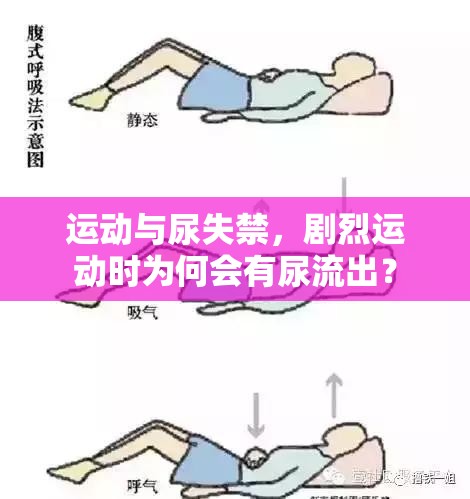 運(yùn)動(dòng)與尿失禁，劇烈運(yùn)動(dòng)時(shí)為何會(huì)有尿流出？
