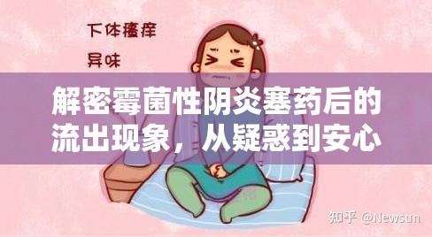 解密霉菌性陰炎塞藥后的流出現(xiàn)象，從疑惑到安心