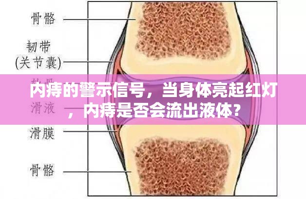 內(nèi)痔的警示信號，當(dāng)身體亮起紅燈，內(nèi)痔是否會流出液體？