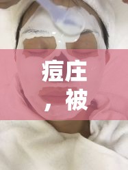 痘莊，被揭露的祛痘陷阱