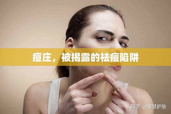 痘莊，被揭露的祛痘陷阱