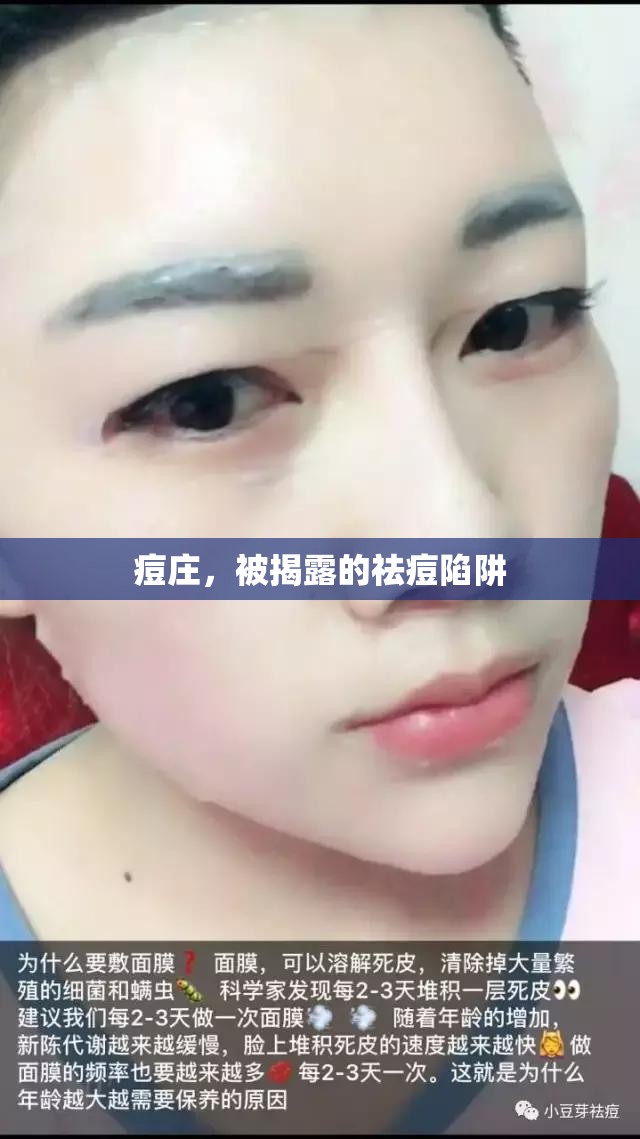 痘莊，被揭露的祛痘陷阱