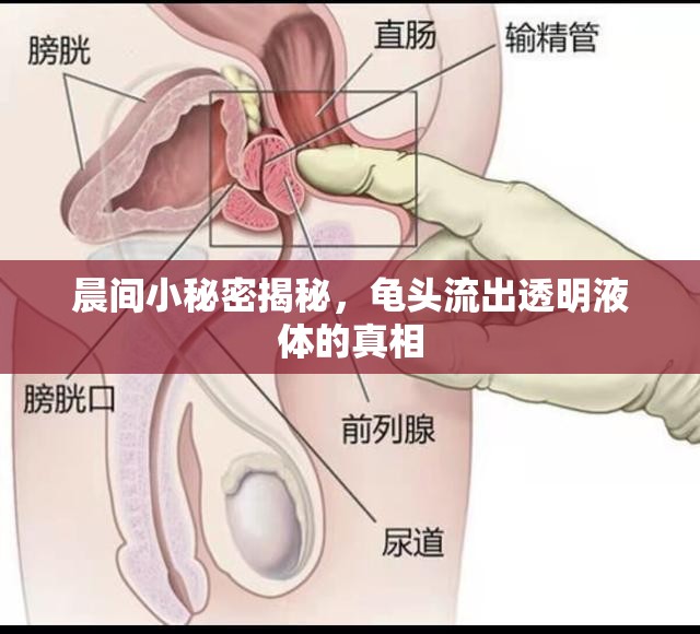晨間小秘密揭秘，龜頭流出透明液體的真相