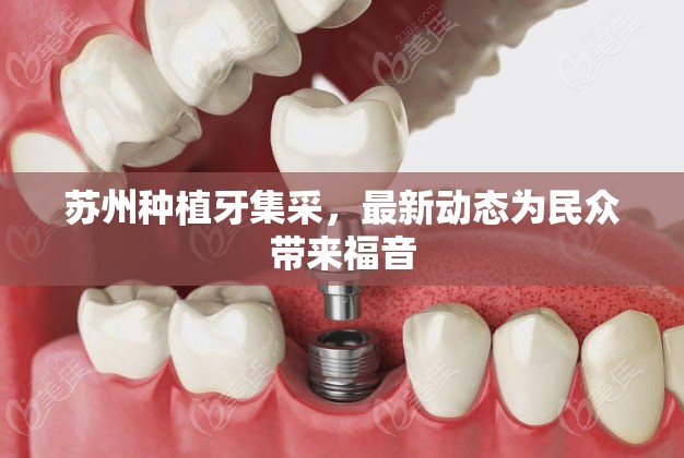 蘇州種植牙集采，最新動(dòng)態(tài)為民眾帶來(lái)福音