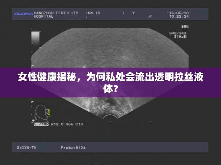 女性健康揭秘，為何私處會(huì)流出透明拉絲液體？