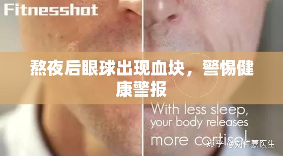 熬夜后眼球出現(xiàn)血塊，警惕健康警報