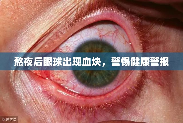 熬夜后眼球出現(xiàn)血塊，警惕健康警報