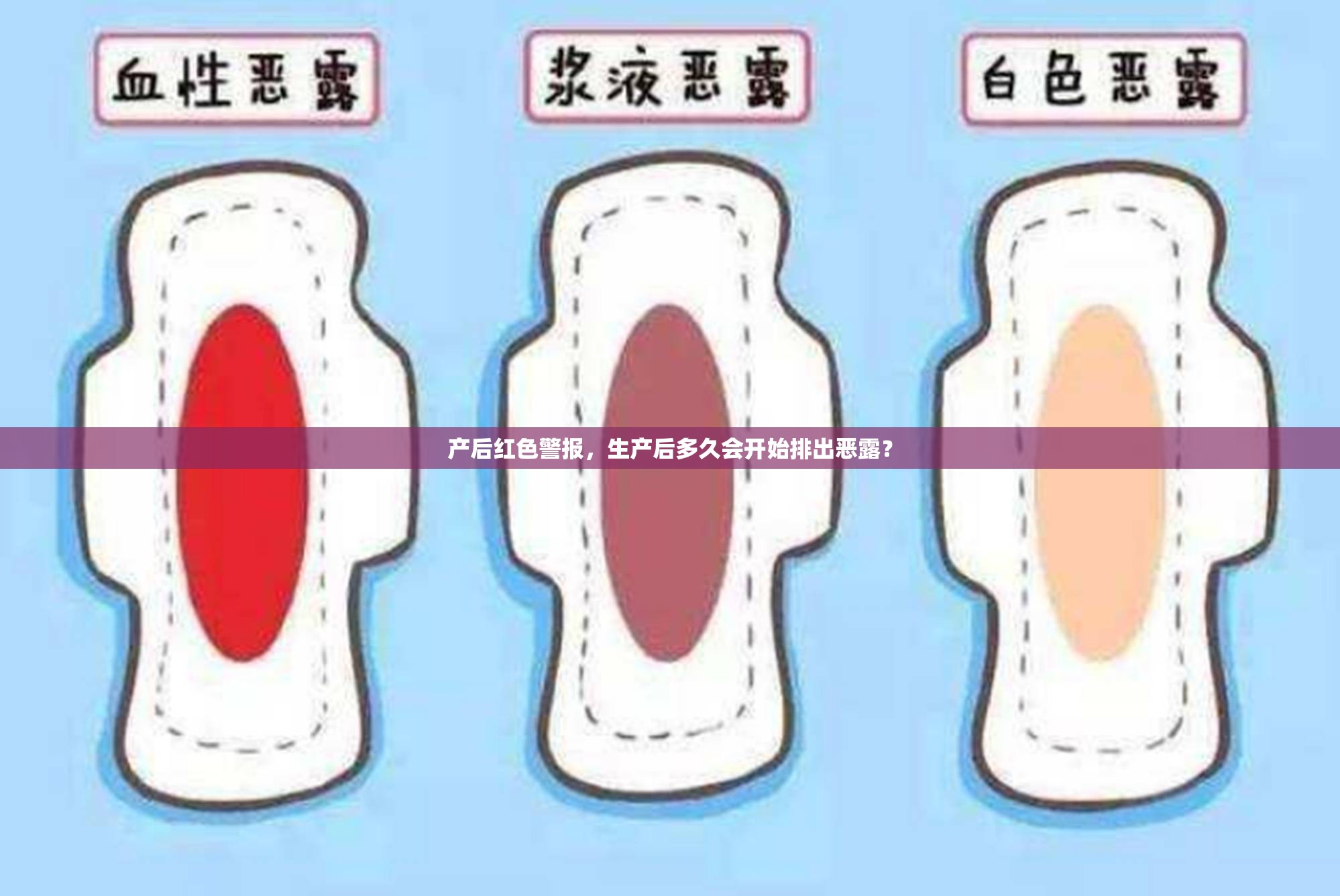 產(chǎn)后紅色警報(bào)，生產(chǎn)后多久會(huì)開(kāi)始排出惡露？