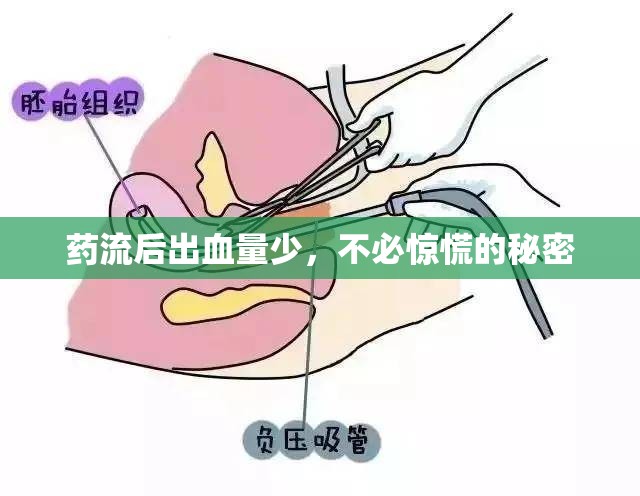藥流后出血量少，不必驚慌的秘密