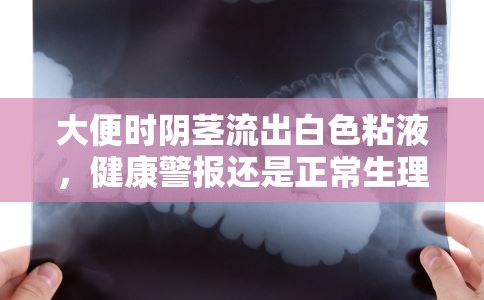 大便時陰莖流出白色粘液，健康警報還是正常生理現(xiàn)象？