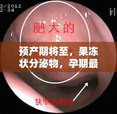 預(yù)產(chǎn)期將至，果凍狀分泌物，孕期最后階段的奇妙信號(hào)