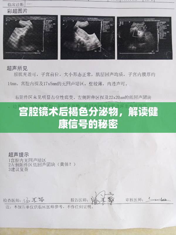 宮腔鏡術(shù)后褐色分泌物，解讀健康信號(hào)的秘密