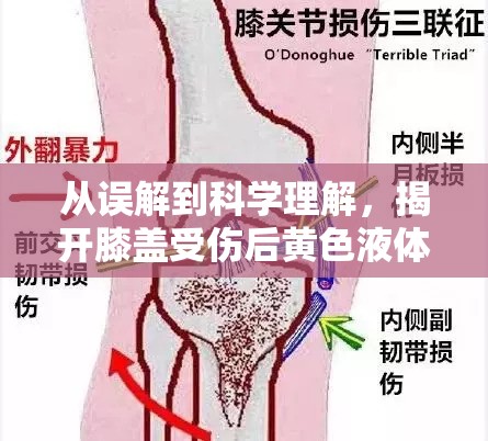 從誤解到科學(xué)理解，揭開膝蓋受傷后黃色液體的秘密