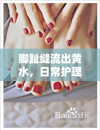 腳趾縫流出黃水，日常護(hù)理與專業(yè)治療全面指南