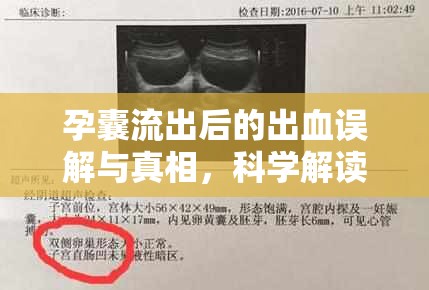 孕囊流出后的出血誤解與真相，科學解讀孕期出血的常見問題