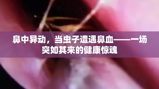 鼻中異動(dòng)，當(dāng)蟲子遭遇鼻血——一場(chǎng)突如其來的健康驚魂