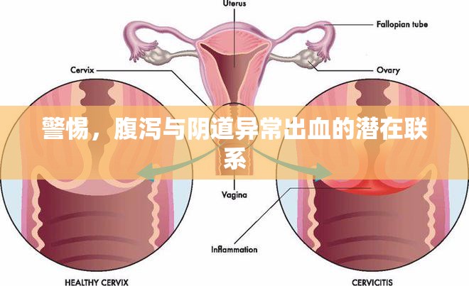 警惕，腹瀉與陰道異常出血的潛在聯(lián)系