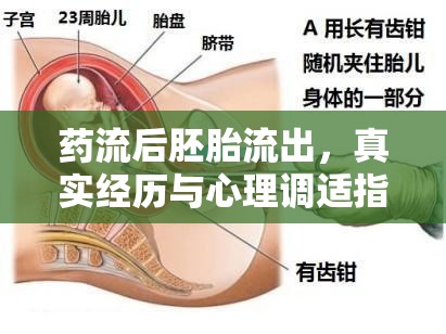 藥流后胚胎流出，真實(shí)經(jīng)歷與心理調(diào)適指南