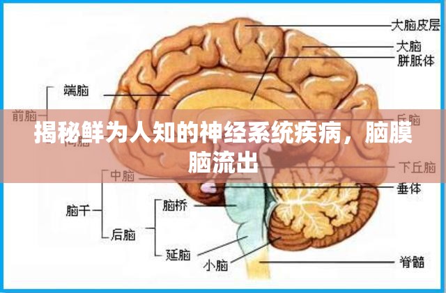 揭秘鮮為人知的神經(jīng)系統(tǒng)疾病，腦膜腦流出
