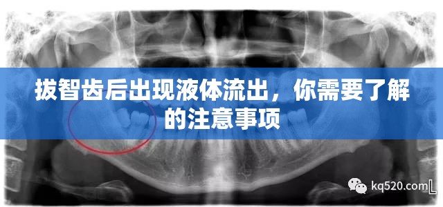 拔智齒后出現(xiàn)液體流出，你需要了解的注意事項