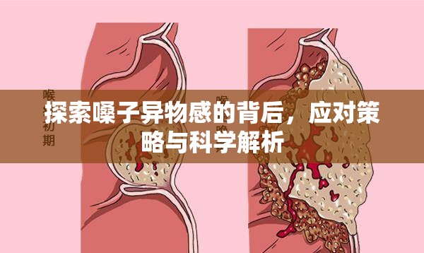 探索嗓子異物感的背后，應(yīng)對策略與科學(xué)解析