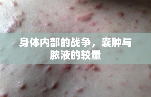 身體內(nèi)部的戰(zhàn)爭，囊腫與膿液的較量