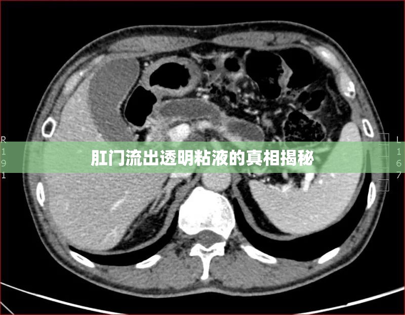 肛門流出透明粘液的真相揭秘