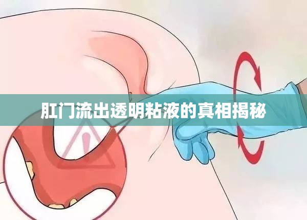 肛門流出透明粘液的真相揭秘