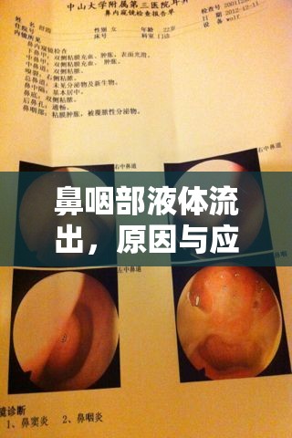 鼻咽部液體流出，原因與應對措施