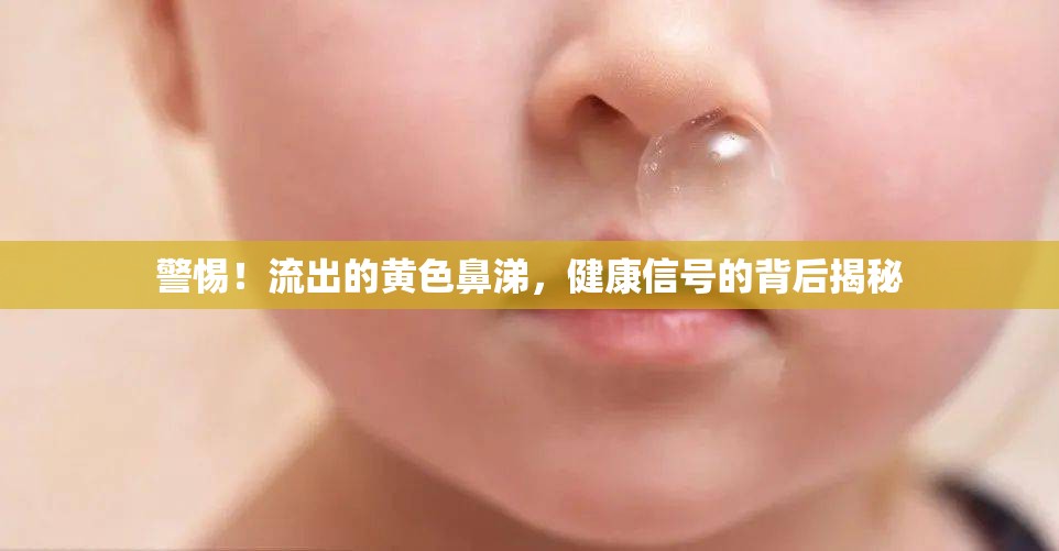 警惕！流出的黃色鼻涕，健康信號的背后揭秘