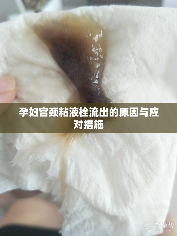 孕婦宮頸粘液栓流出的原因與應(yīng)對(duì)措施
