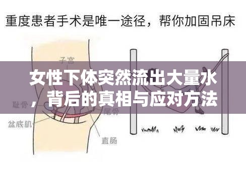女性下體突然流出大量水，背后的真相與應對方法