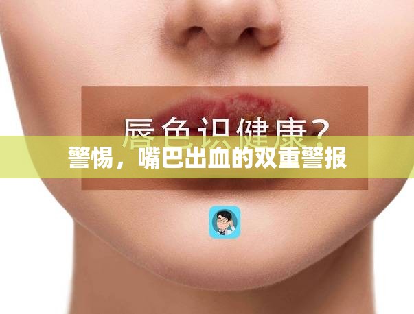警惕，嘴巴出血的雙重警報