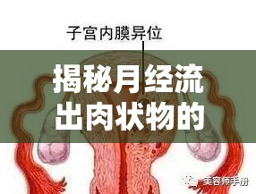 揭秘月經(jīng)流出肉狀物的真相，生理現(xiàn)象與健康解讀