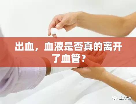 出血，血液是否真的離開(kāi)了血管？