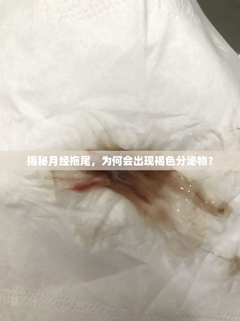 揭秘月經(jīng)拖尾，為何會出現(xiàn)褐色分泌物？