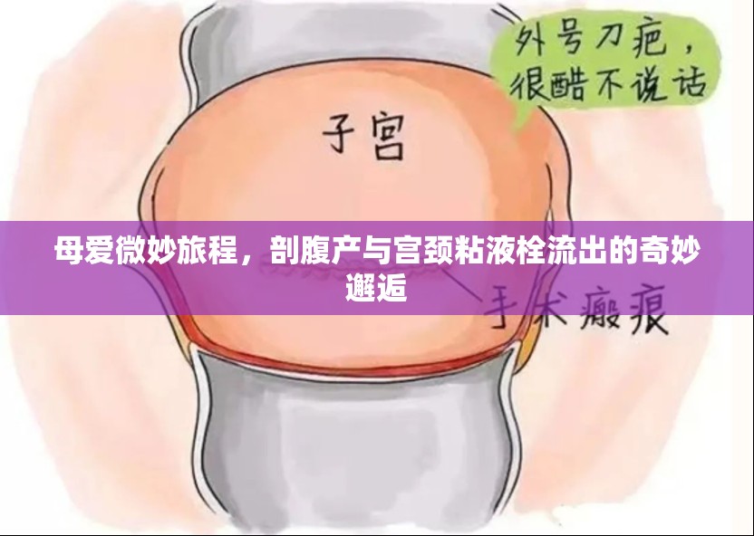 母愛(ài)微妙旅程，剖腹產(chǎn)與宮頸粘液栓流出的奇妙邂逅