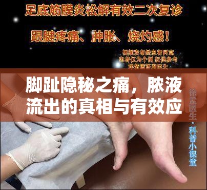 腳趾隱秘之痛，膿液流出的真相與有效應(yīng)對(duì)策略