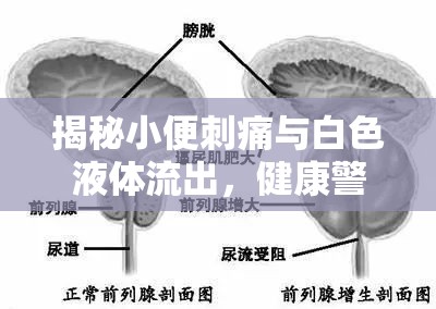 揭秘小便刺痛與白色液體流出，健康警報及應(yīng)對策略