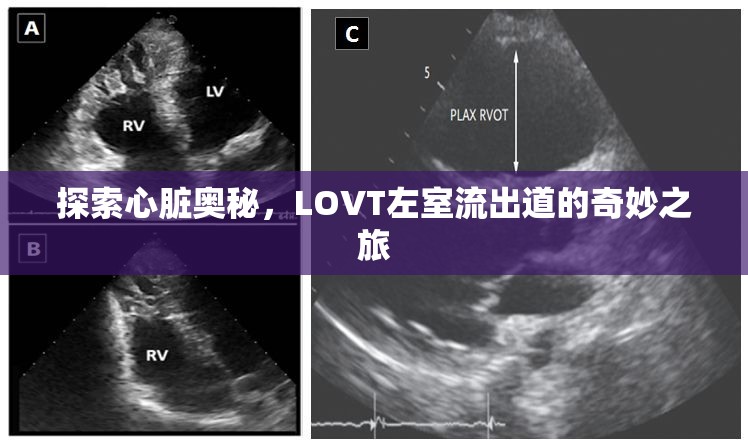 探索心臟奧秘，LOVT左室流出道的奇妙之旅