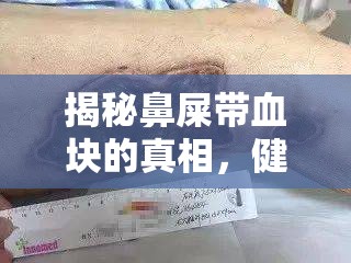 揭秘鼻屎帶血塊的真相，健康警鐘與日常護理指南