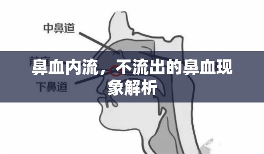 鼻血內(nèi)流，不流出的鼻血現(xiàn)象解析