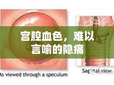 宮腔血色，難以言喻的隱痛