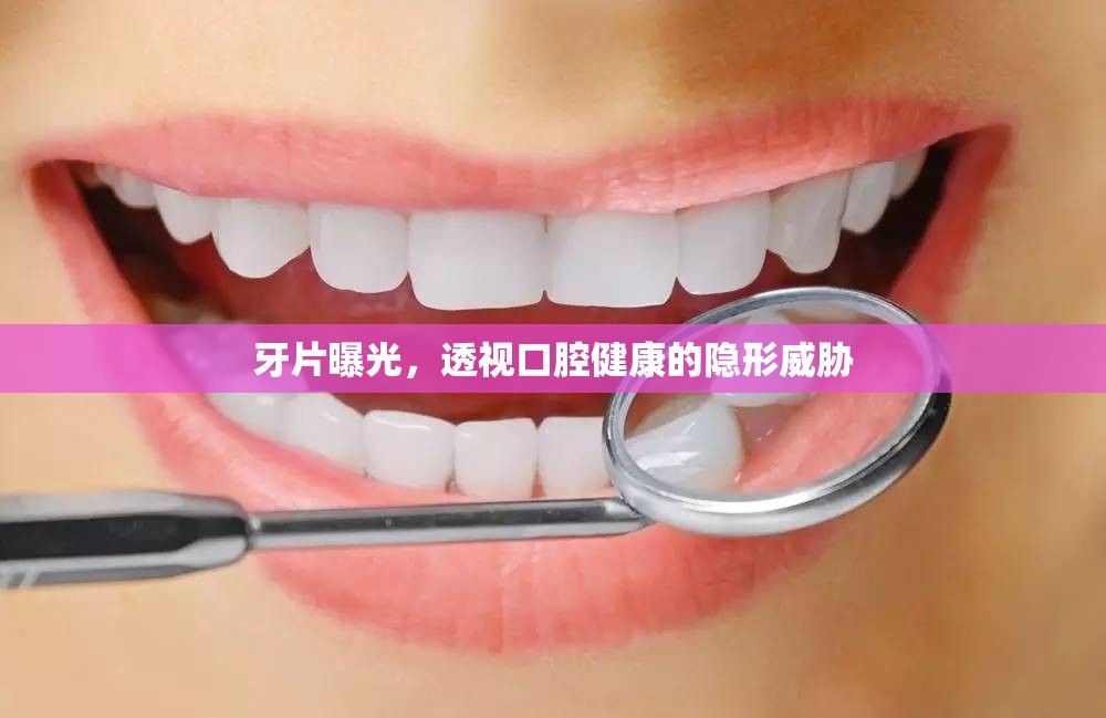 牙片曝光，透視口腔健康的隱形威脅